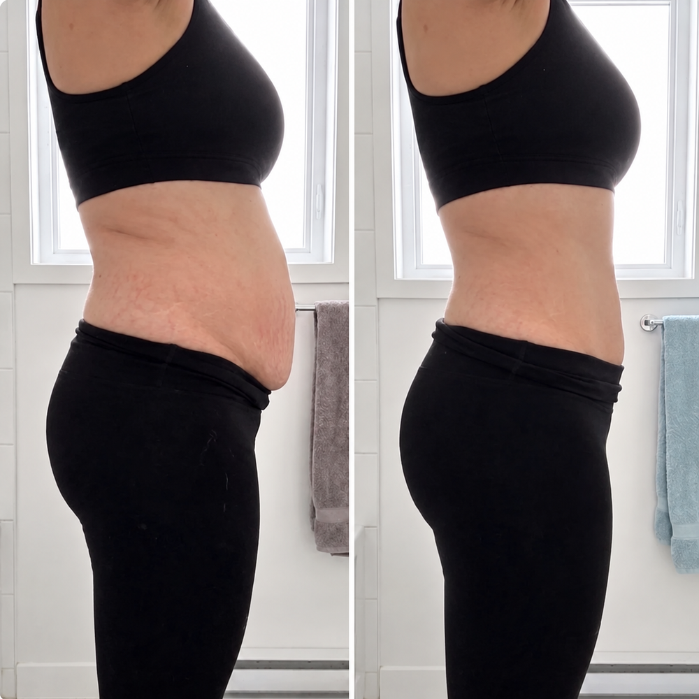 Lovelle Form – Postpartum Knickers with 360° Compression