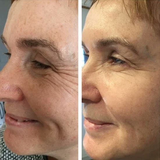 Customer photo of Lovelle Glow
