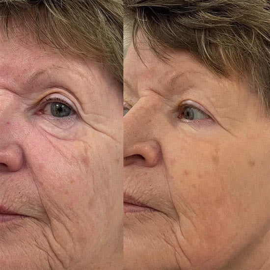 Customer photo of Lovelle Glow